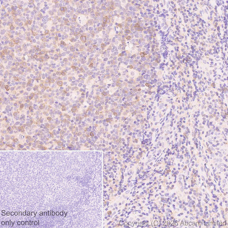 Immunohistochemistry (Formalin/PFA-fixed paraffin-embedded sections) - Anti-CD45RB antibody [EPR31068-523] - BSA and Azide free (AB326731)