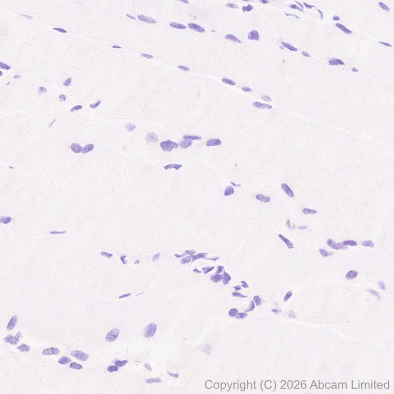 Immunohistochemistry (Formalin/PFA-fixed paraffin-embedded sections) - Anti-CD45RB antibody [EPR31068-523] - BSA and Azide free (AB326731)