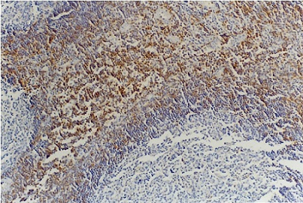 Immunohistochemistry (Formalin/PFA-fixed paraffin-embedded sections) - Anti-CD45RB antibody [MEM-55] (AB8218)