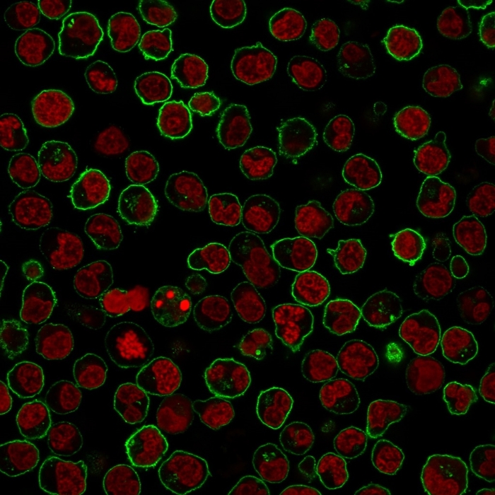 Immunocytochemistry - Anti-CD45RB antibody [PTPRC/1783R] (AB218504), expandable thumbnail