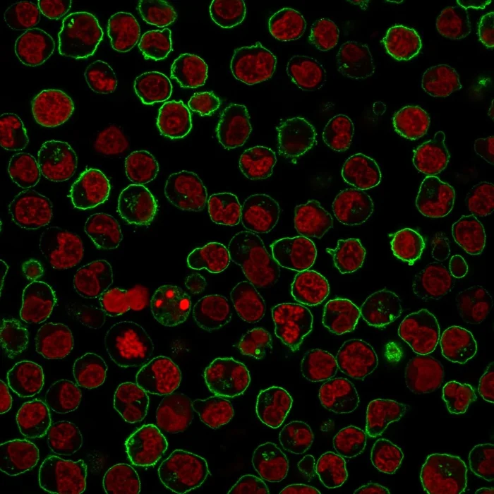 Immunocytochemistry - Anti-CD45RB antibody [PTPRC/1783R] (AB218504)