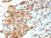 Immunohistochemistry (Formalin/PFA-fixed paraffin-embedded sections) - Anti-CD45RB antibody [PTPRC/1783R] (AB218504), expandable thumbnail