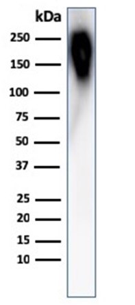 Western blot - Anti-CD45RB antibody [PTPRC/1783R] (AB218504), expandable thumbnail