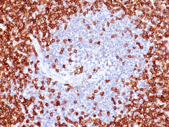 Immunohistochemistry (Formalin/PFA-fixed paraffin-embedded sections) - Anti-CD45RO antibody [T200/797] - BSA and Azide free (AB212786), expandable thumbnail