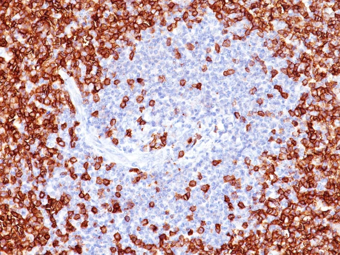 Immunohistochemistry (Formalin/PFA-fixed paraffin-embedded sections) - Anti-CD45RO antibody [T200/797] - BSA and Azide free (AB212786)