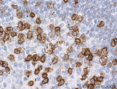 Immunohistochemistry (Formalin/PFA-fixed paraffin-embedded sections) - Anti-CD45RO antibody [UCHL1] (AB23)