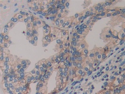 Immunohistochemistry (Formalin/PFA-fixed paraffin-embedded sections) - Anti-CD46 antibody (AB231984)