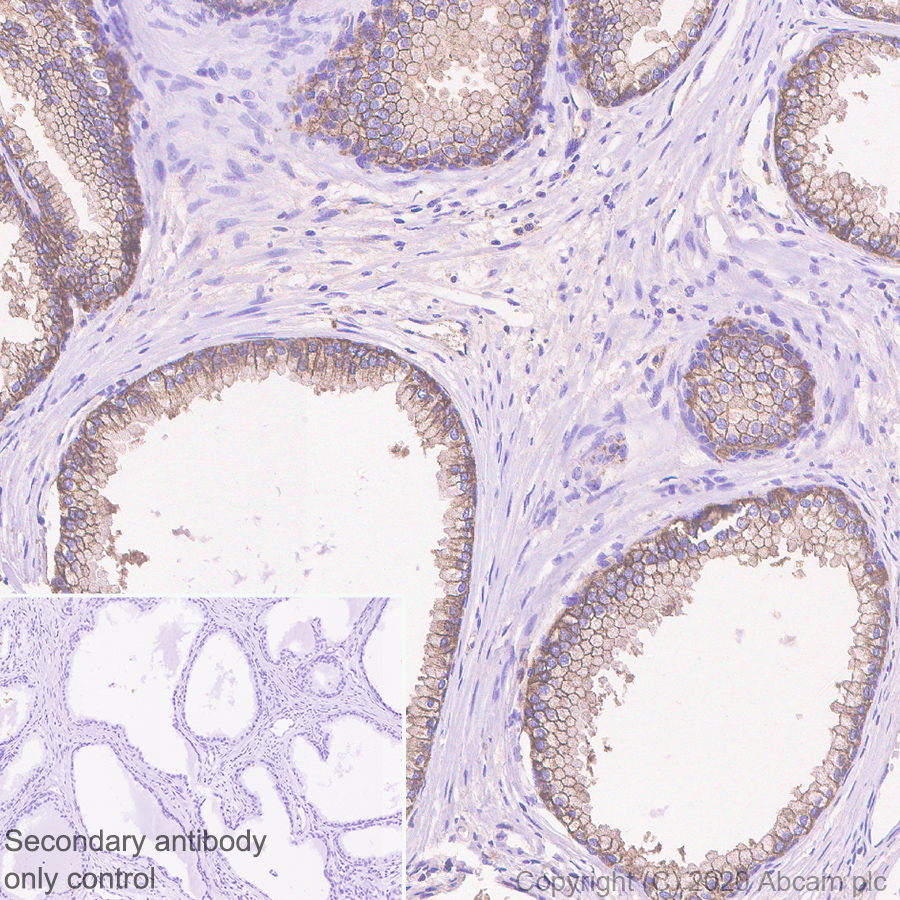 Immunohistochemistry (Formalin/PFA-fixed paraffin-embedded sections) - Anti-CD46 antibody [EPR23242-171] (AB273583), expandable thumbnail