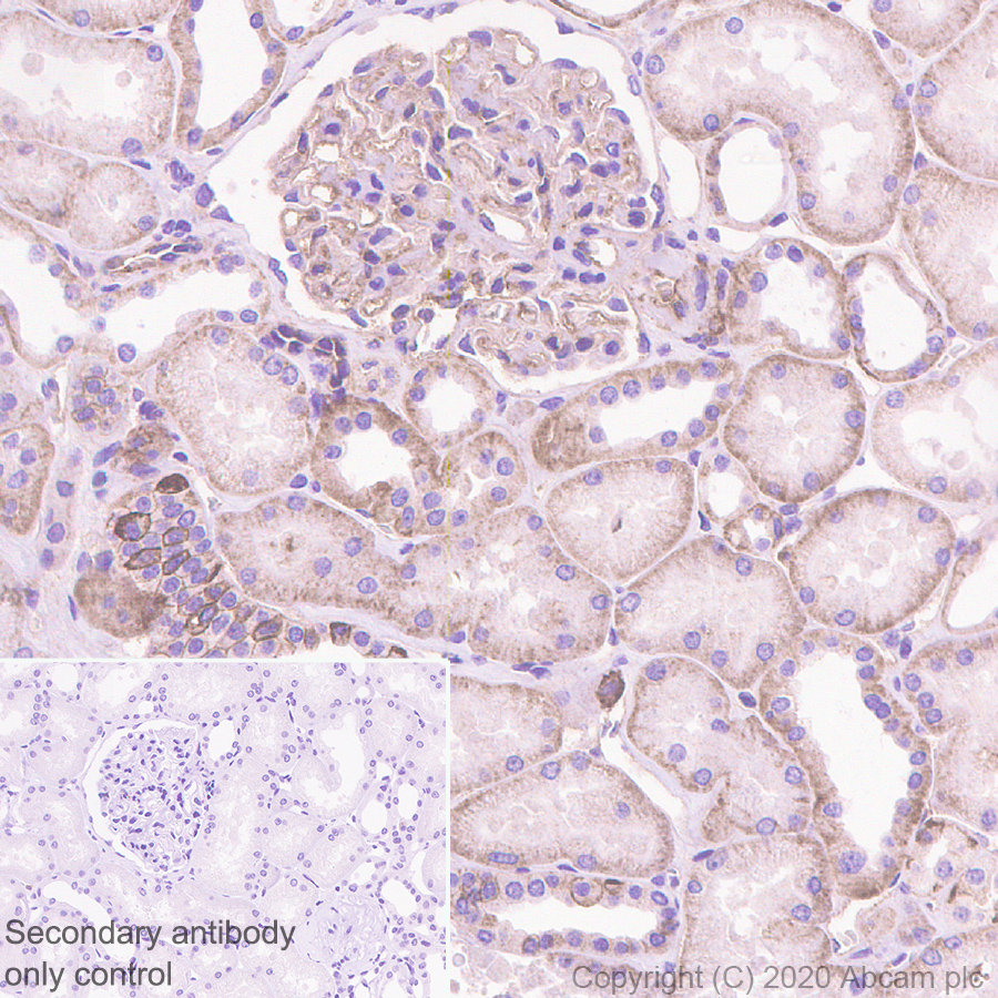 Immunohistochemistry (Formalin/PFA-fixed paraffin-embedded sections) - Anti-CD46 antibody [EPR23242-171] (AB273583), expandable thumbnail