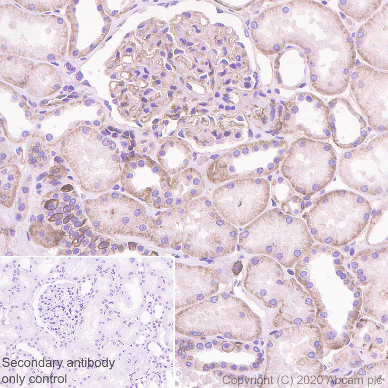 Immunohistochemistry (Formalin/PFA-fixed paraffin-embedded sections) - Anti-CD46 antibody [EPR23242-171] (AB273583)