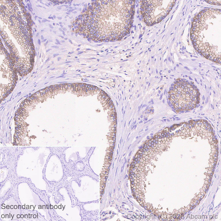 Immunohistochemistry (Formalin/PFA-fixed paraffin-embedded sections) - Anti-CD46 antibody [EPR23242-171] - BSA and Azide free (AB273588)