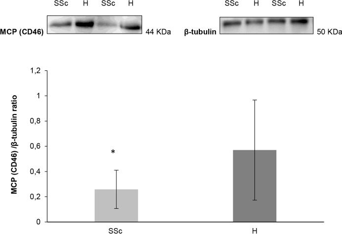 Western blot - Anti-CD46 antibody [EPR4014] (ab108307), expandable thumbnail