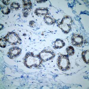 Immunohistochemistry (Formalin/PFA-fixed paraffin-embedded sections) - Anti-CD46 antibody [EPR4014] - BSA and Azide free (ab271871), expandable thumbnail