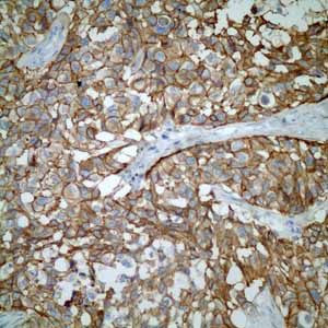 Immunohistochemistry (Formalin/PFA-fixed paraffin-embedded sections) - Anti-CD46 antibody [EPR4014] - BSA and Azide free (ab271871), expandable thumbnail