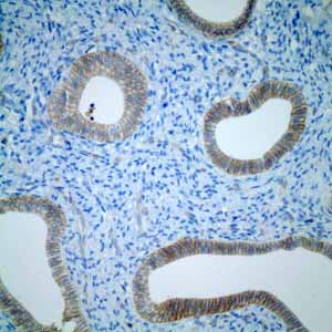 Immunohistochemistry (Formalin/PFA-fixed paraffin-embedded sections) - Anti-CD46 antibody [EPR4014] - BSA and Azide free (ab271871), expandable thumbnail