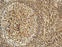 Immunohistochemistry (Formalin/PFA-fixed paraffin-embedded sections) - Anti-CD46 antibody [EPR4014] - BSA and Azide free (AB271871), expandable thumbnail