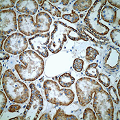 Immunohistochemistry (Formalin/PFA-fixed paraffin-embedded sections) - Anti-CD46 antibody [EPR4014] - BSA and Azide free (AB271871), expandable thumbnail