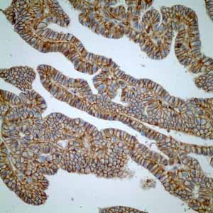 Immunohistochemistry (Formalin/PFA-fixed paraffin-embedded sections) - Anti-CD46 antibody [EPR4014] - BSA and Azide free (ab271871), expandable thumbnail