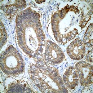 Immunohistochemistry (Formalin/PFA-fixed paraffin-embedded sections) - Anti-CD46 antibody [EPR4014] - BSA and Azide free (ab271871), expandable thumbnail