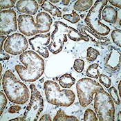 Immunohistochemistry (Formalin/PFA-fixed paraffin-embedded sections) - Anti-CD46 antibody [EPR4014] - Low endotoxin, Azide free (AB229446)