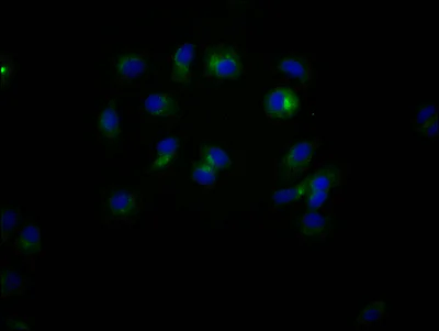 Immunocytochemistry/ Immunofluorescence - Anti-CD47 antibody [4G11] (AB314170)