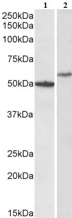 Western blot - Anti-CD47 antibody (AB193940)