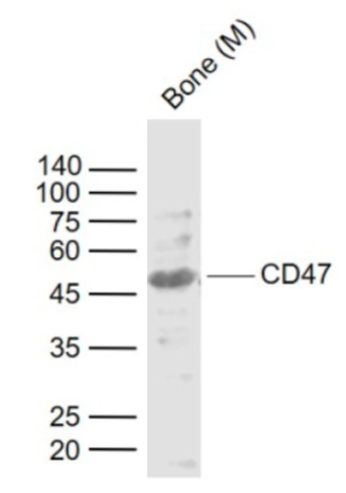 Western blot - Anti-CD47 antibody (AB214453), expandable thumbnail
