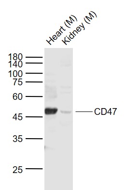 Western blot - Anti-CD47 antibody (AB214453), expandable thumbnail