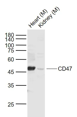Western blot - Anti-CD47 antibody (AB214453)