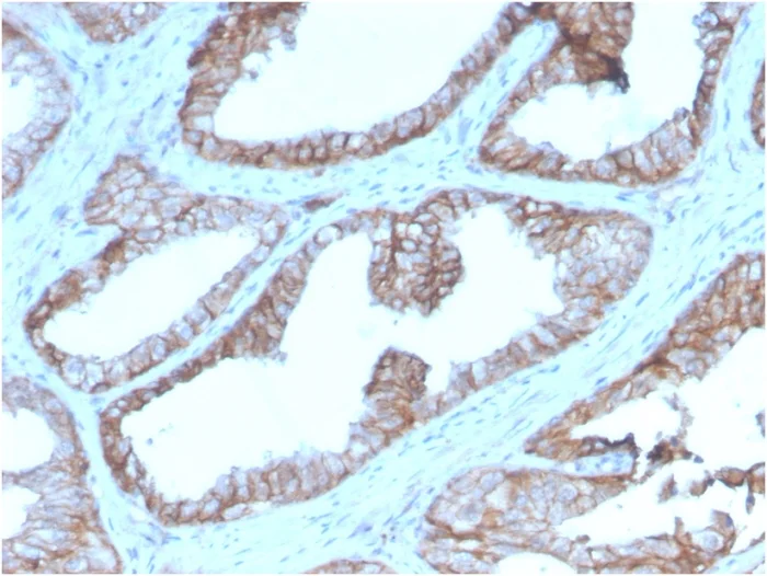 Immunohistochemistry (Formalin/PFA-fixed paraffin-embedded sections) - Anti-CD47 antibody [CD47/2937] - BSA and Azide free (AB260480)