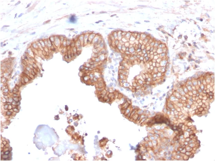 Immunohistochemistry (Formalin/PFA-fixed paraffin-embedded sections) - Anti-CD47 antibody [CD47/2937] - BSA and Azide free (AB260480)