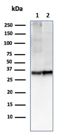 Western blot - Anti-CD47 antibody [CD47/2937] - BSA and Azide free (AB260480)