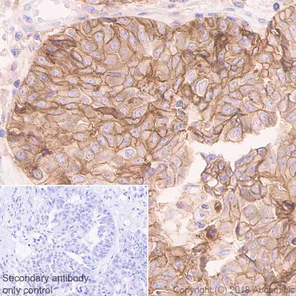 Immunohistochemistry (Formalin/PFA-fixed paraffin-embedded sections) - Anti-CD47 antibody [EPR21794] (AB218810)