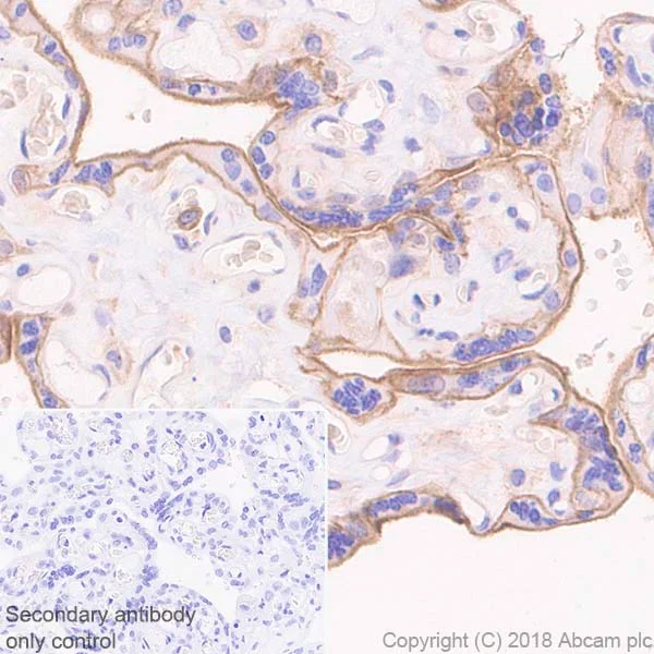 Immunohistochemistry (Formalin/PFA-fixed paraffin-embedded sections) - Anti-CD47 antibody [EPR21794] (AB218810)