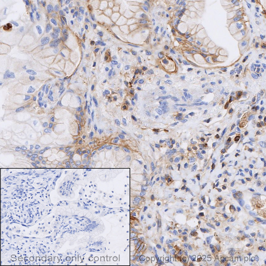 Immunohistochemistry (Formalin/PFA-fixed paraffin-embedded sections) - Anti-CD47 antibody [EPR21794] (AB218810)