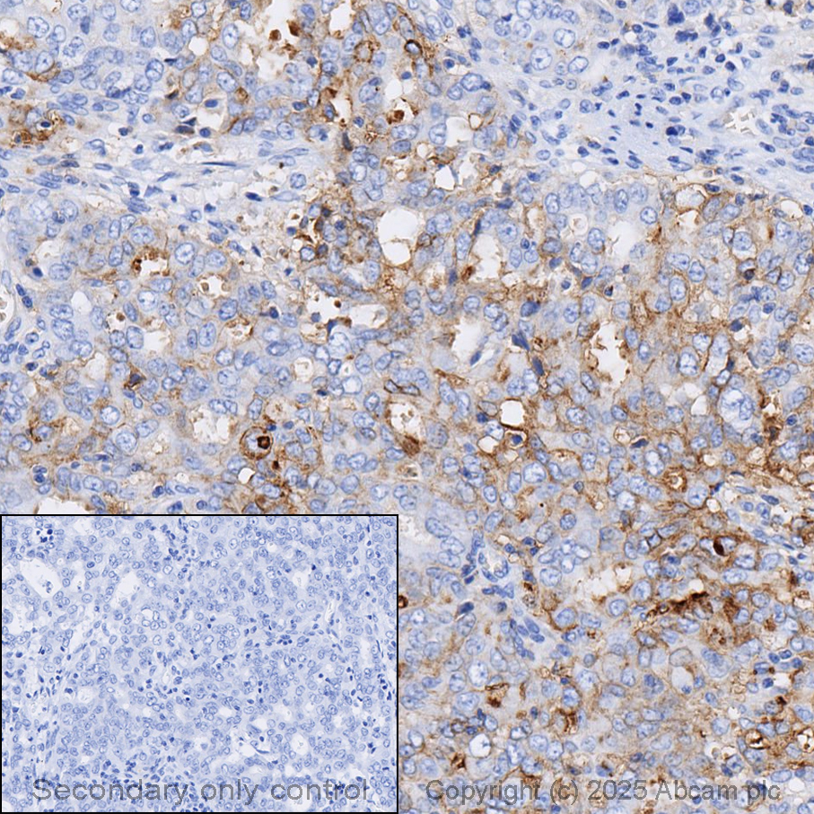 Anti-CD47 antibody [EPR21794] (ab218810) | Abcam
