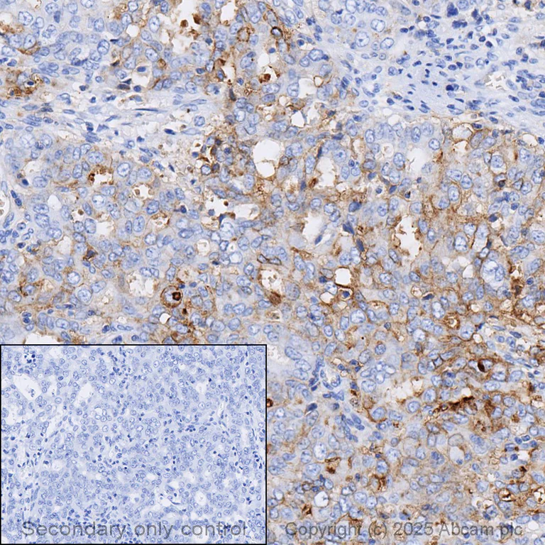 Immunohistochemistry (Formalin/PFA-fixed paraffin-embedded sections) - Anti-CD47 antibody [EPR21794] (AB218810)