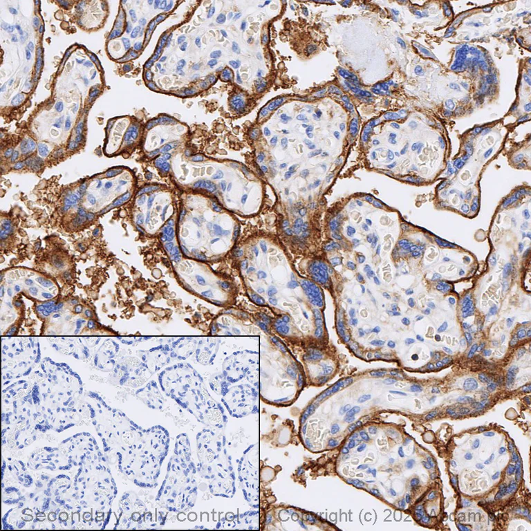 Immunohistochemistry (Formalin/PFA-fixed paraffin-embedded sections) - Anti-CD47 antibody [EPR21794] (AB218810)