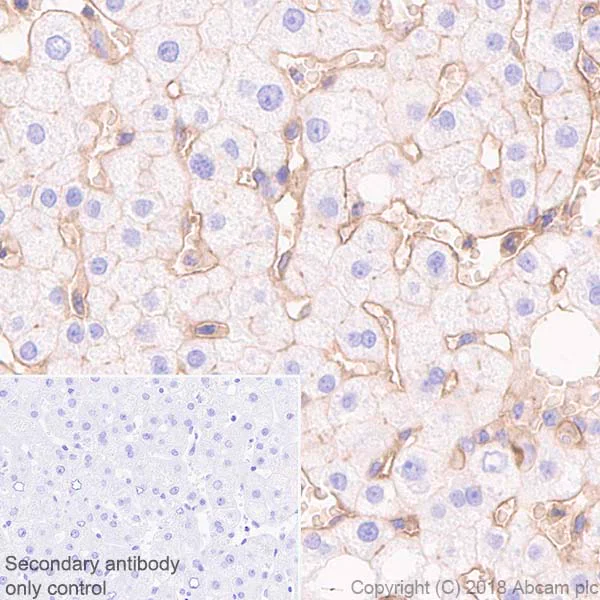 Immunohistochemistry (Formalin/PFA-fixed paraffin-embedded sections) - Anti-CD47 antibody [EPR21794] (AB218810)