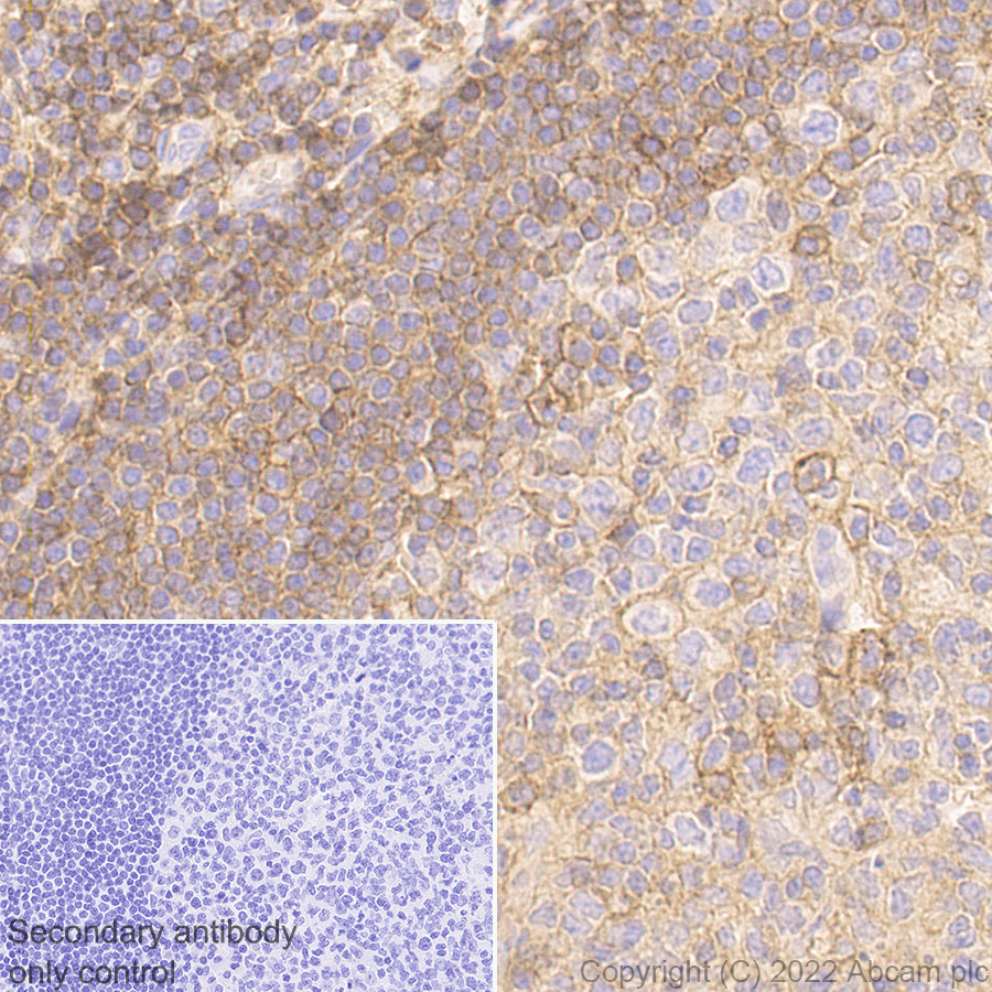 Immunohistochemistry (Formalin/PFA-fixed paraffin-embedded sections) - Anti-CD47 antibody [EPR24922-5] (AB300435), expandable thumbnail