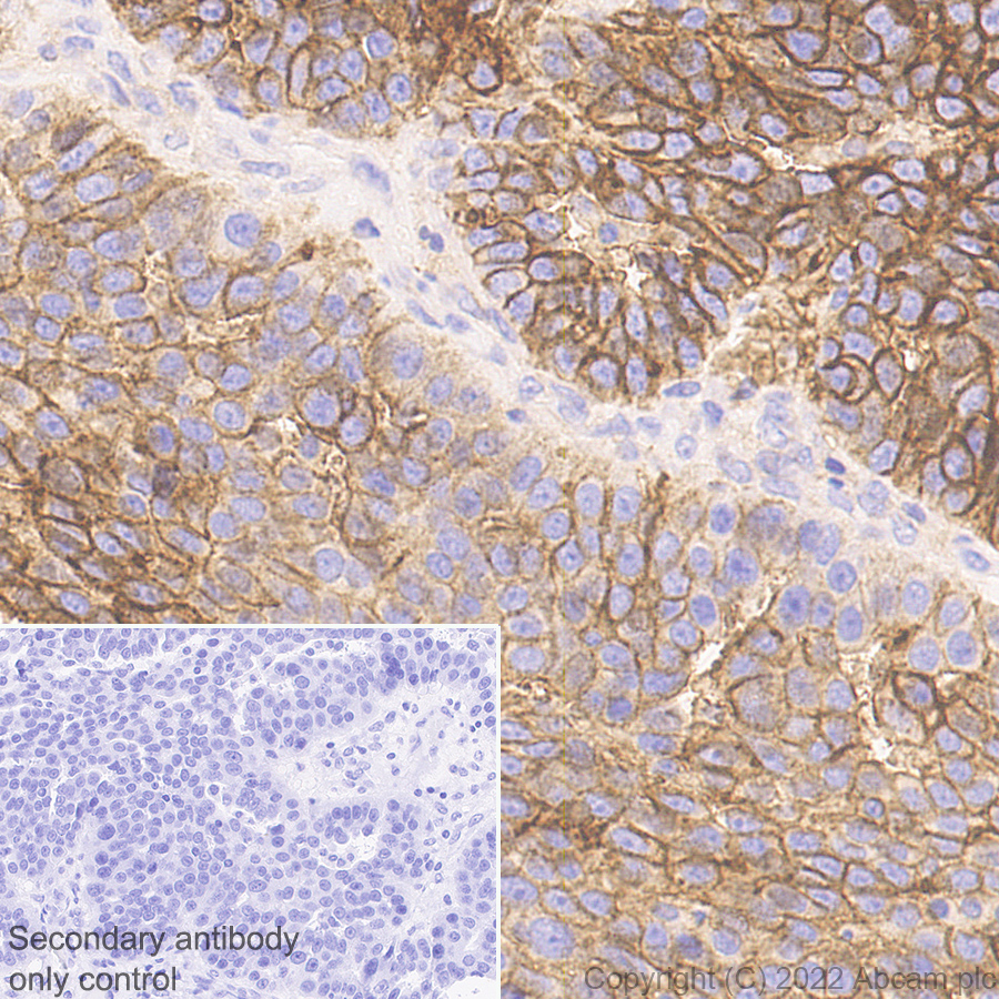 Immunohistochemistry (Formalin/PFA-fixed paraffin-embedded sections) - Anti-CD47 antibody [EPR24922-5] (AB300435), expandable thumbnail
