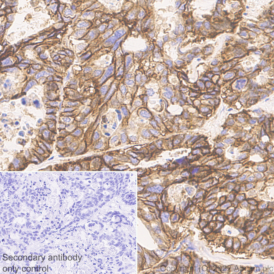 Immunohistochemistry (Formalin/PFA-fixed paraffin-embedded sections) - Anti-CD47 antibody [EPR24922-5] (AB300435), expandable thumbnail