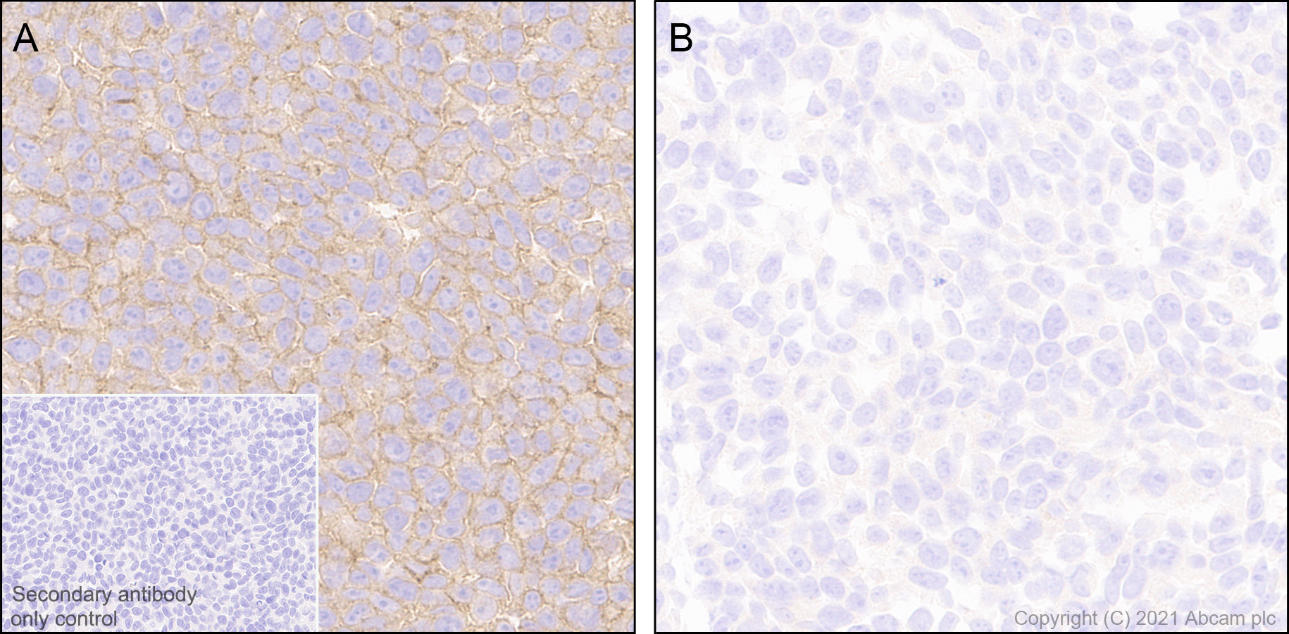 Immunohistochemistry (Formalin/PFA-fixed paraffin-embedded sections) - Anti-CD47 antibody [EPR24922-5] (AB300435), expandable thumbnail