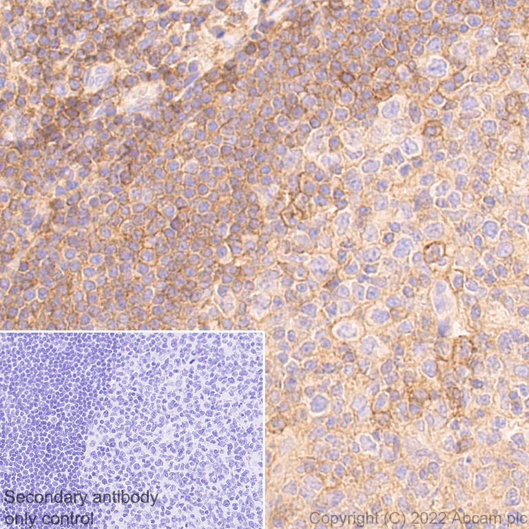 Immunohistochemistry (Formalin/PFA-fixed paraffin-embedded sections) - Anti-CD47 antibody [EPR24922-5] (BSA and Azide free) (AB300436)