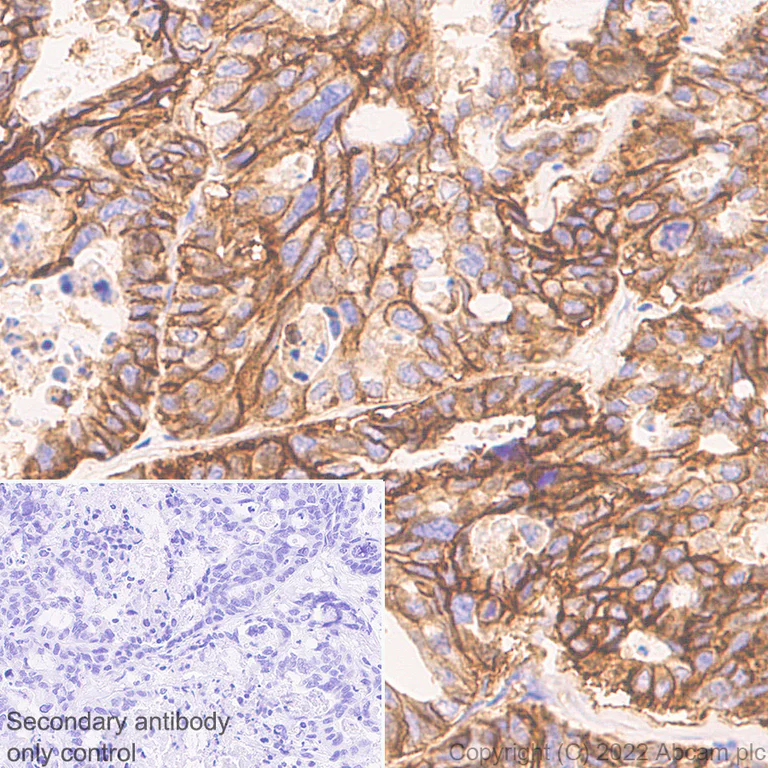 Immunohistochemistry (Formalin/PFA-fixed paraffin-embedded sections) - Anti-CD47 antibody [EPR24922-5] (BSA and Azide free) (AB300436)