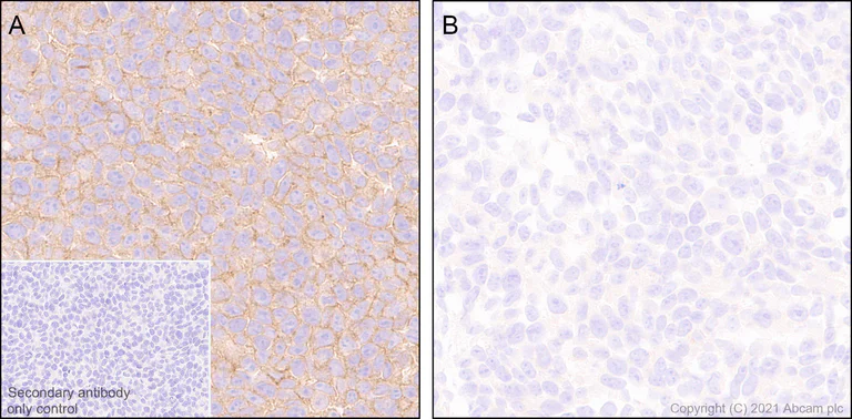 Immunohistochemistry (Formalin/PFA-fixed paraffin-embedded sections) - Anti-CD47 antibody [EPR24922-5] (BSA and Azide free) (AB300436)