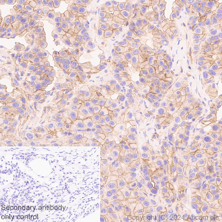 Immunohistochemistry (Formalin/PFA-fixed paraffin-embedded sections) - Anti-CD47 antibody [EPR28770-376] (AB319049)