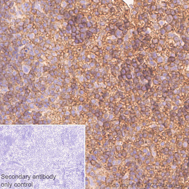 Immunohistochemistry (Formalin/PFA-fixed paraffin-embedded sections) - Anti-CD47 antibody [EPR28770-376] - BSA and Azide free (AB319050)