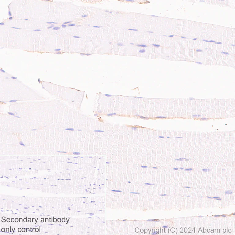 Immunohistochemistry (Formalin/PFA-fixed paraffin-embedded sections) - Anti-CD47 antibody [EPR28770-376] - BSA and Azide free (AB319050)