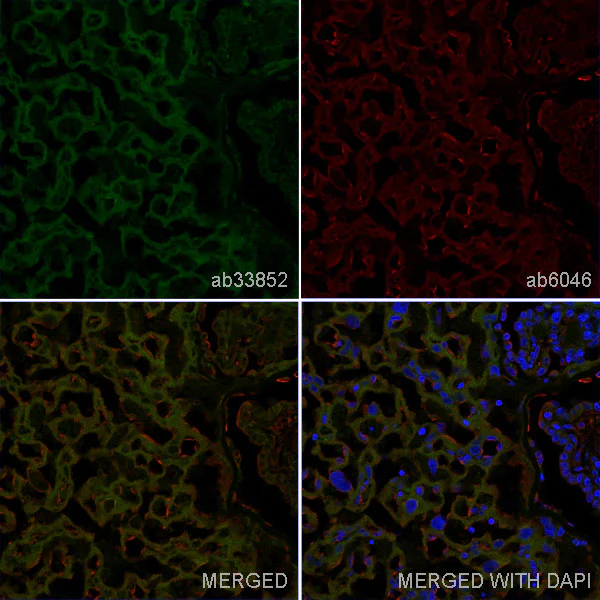 Immunohistochemistry (Frozen sections) - Anti-CD47 antibody [OX-101] (AB33852)